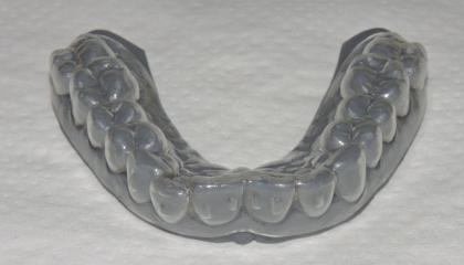 Clear aligners to straighten the teeth